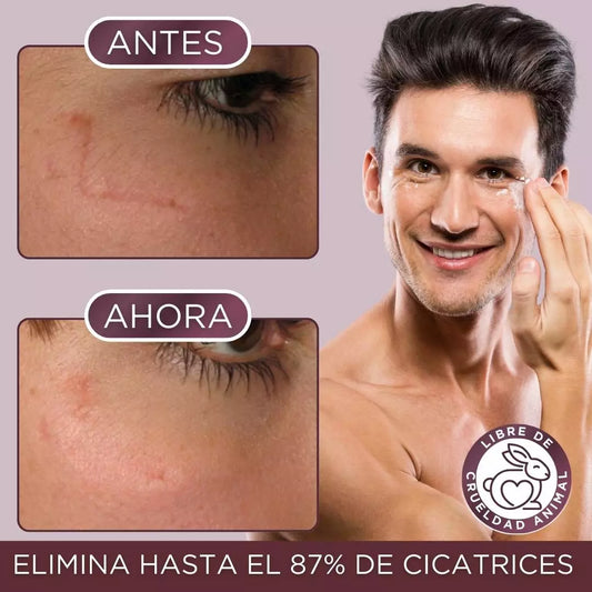 Kit Acné, Détox, Cicatrices, Poros Dilatados (BL1 Beauclean + BL2)