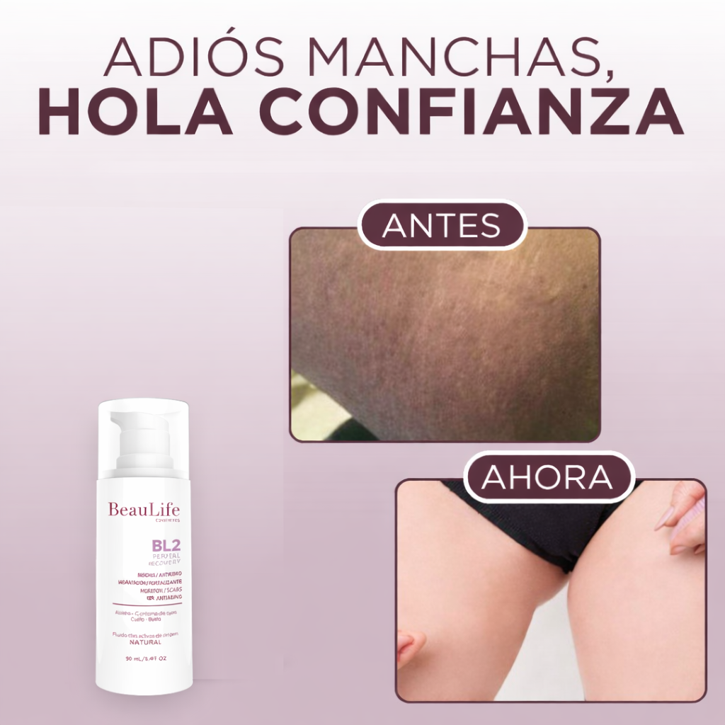 Intibelle (BL 2, Manchas y cicatrices incómodas)