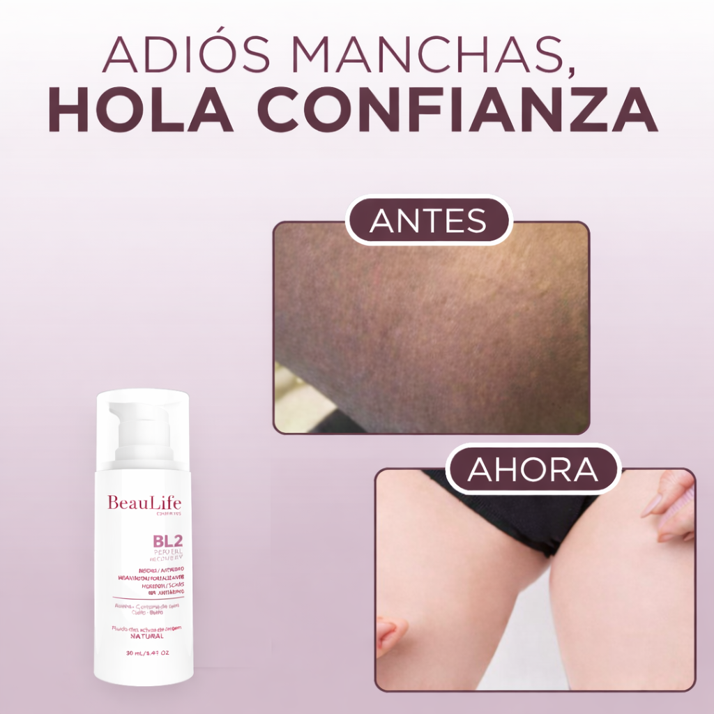 Intibelle (BL 2, Manchas y cicatrices incómodas)