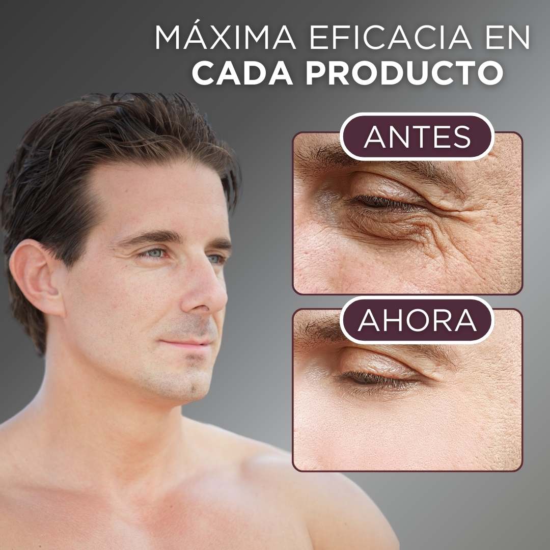 KIT COMPLETO ANTIEDAD MANCHAS HOMBRES (BL1 + TOTAL RECOVERY+ PROTECTOR SOLAR+ BEAUTONER) + AGUA TERMAL GRATIS