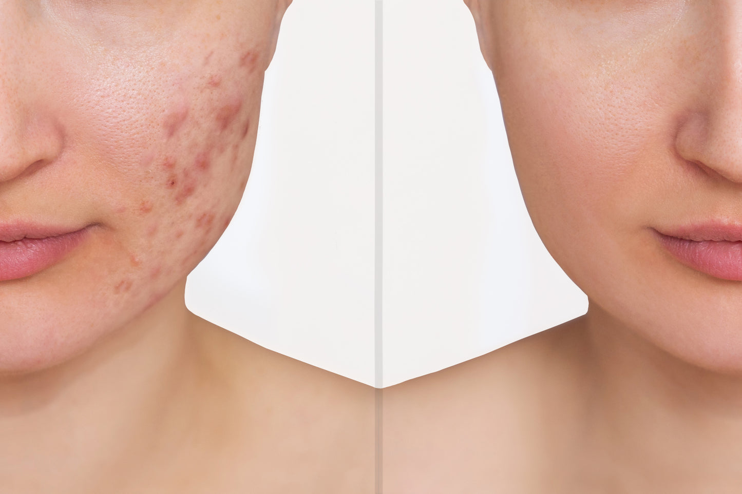 TOTAL RECOVERY – Manchas, Arrugas, Ojeras Nanotech Rostro, cuello y Contorno de ojos 30gr