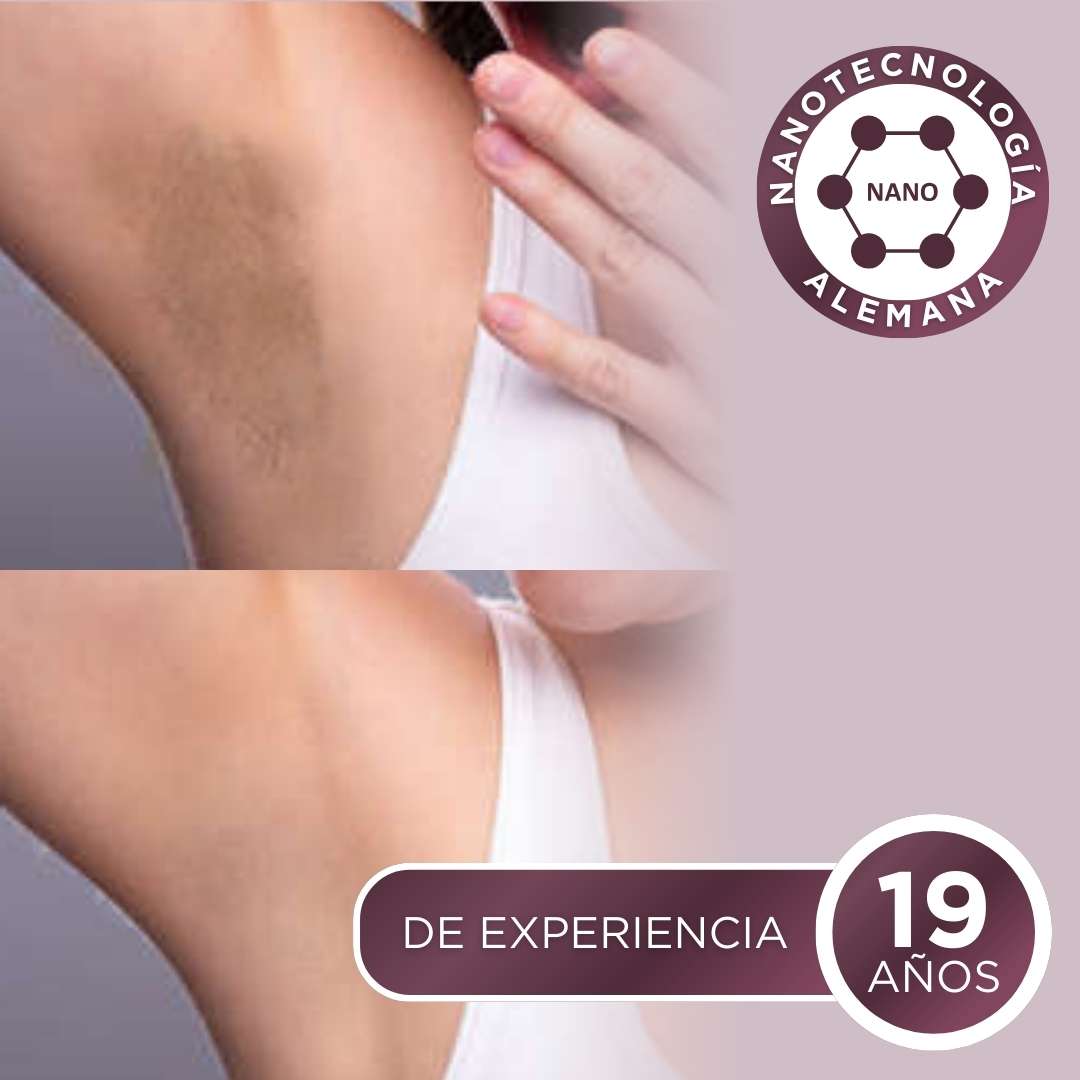 Kit intibelle (incluye BL 1 + BL 2)