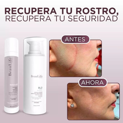 Kit Acné, Détox, Cicatrices, Poros Dilatados (BL1 Beauclean + BL2)