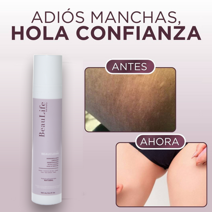 Intibelle (BL 1, Manchas y cicatrices incómodas)